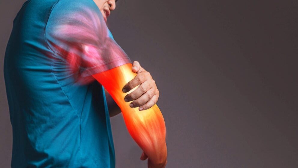 Tennisarm