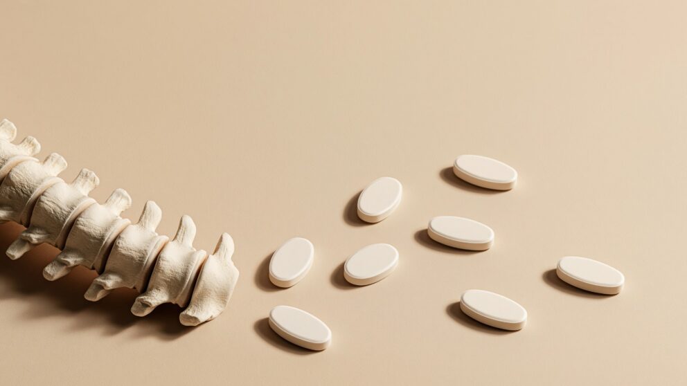 Erkennen und Behandeln: Die drei Säulen einer Osteoporose-Therapie