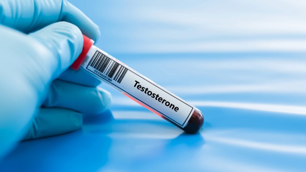 Testosteron