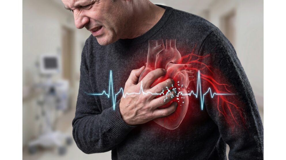 Virusinfekt und Herzinfarkt