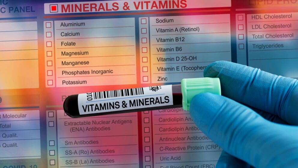 Vitaminmangel trotz gesunder Ernährung? Warum offizielle Grenzwerte nicht genügen